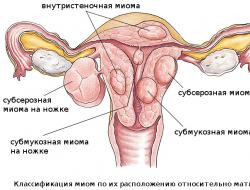 Рак на тялото и шийката на матката: симптоми и лечение