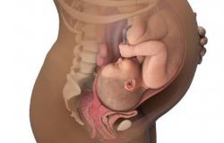 Ebaküpse emakakaela mõju sünnitusele