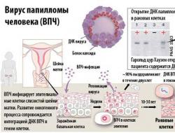 Аюултай онкоген HPV код 16 - хүний ​​хөхөнцөр вирус