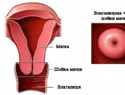Cerviciti: simptomat dhe trajtimi