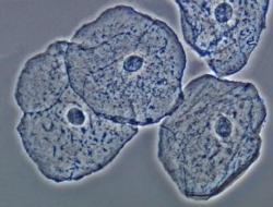 Werte des Plattenepithels in einem Abstrich für die Zytologie